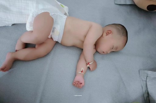 霸州六个月宝宝眼睛散光